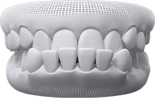 invisalign before after